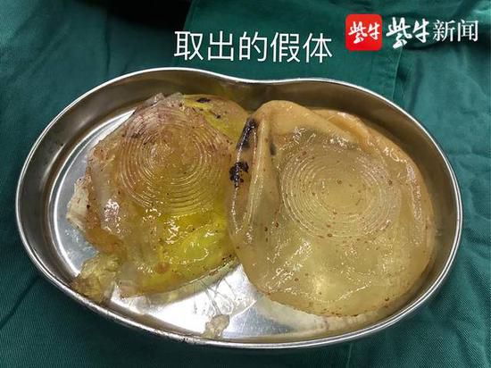 幸运9彩票下载