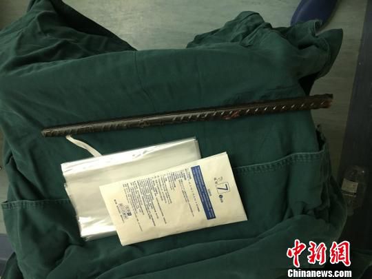 圖為醫生取出的體內鋼筋。院方供圖