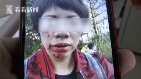 |花园散步巨型贵宾扑了过来...邻居之间大打出手