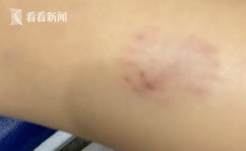 狗|女孩逗狗被咬伤，双方协商后家长为何将狗摔死？