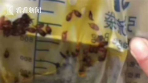 |吃淡水鱼生32年 医生从他体内掏出一包＂瓜子仁＂