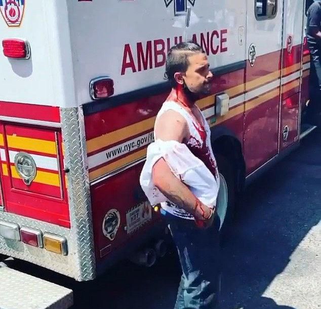 国际社会大写的淡定！纽约男子头顶插菜刀，仍与旁观者冷静交谈