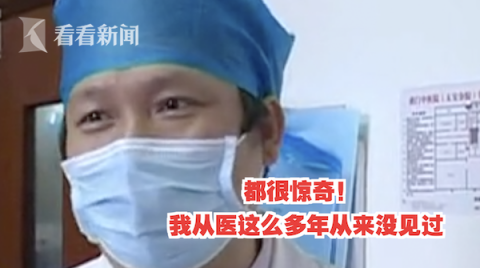 腹膜高烧腰疼半年 男子手术取出5厘米牙签已戳穿腹膜