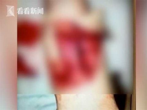 辅警|男子疯狂冲卡撞伤辅警 称吃了槟榔担心测出酒驾