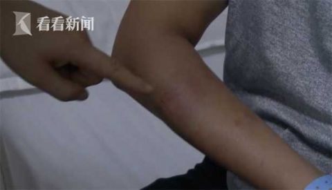 狗|遛狗不栓绳！大狗咬了小狗，主人也直接上嘴咬人