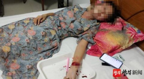 法制|丈夫报警妻子宾馆割腕轻生 民警火速赶到发现对方已割开几道伤口