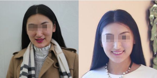 刚公布为缓解看牙难看牙贵湖北省公益征集1280岁问题牙市民