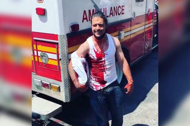 国际社会大写的淡定！纽约男子头顶插菜刀，仍与旁观者冷静交谈