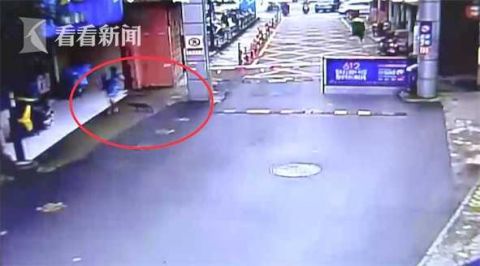 |吓人！2岁男童被黑狗袭击 脸部被咬伤齿痕明显