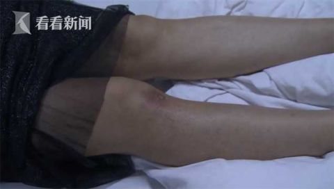 狗|遛狗不栓绳！大狗咬了小狗，主人也直接上嘴咬人