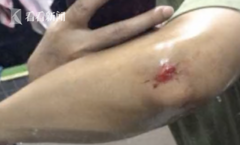 狗|女孩逗狗被咬伤，双方协商后家长为何将狗摔死？