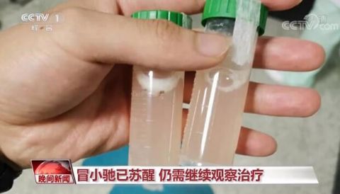 |心疼！被洪水卷走负伤战士呼吸道有浮萍草